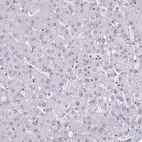Immunohistochemical staining of human liver shows no positivity in hepatocytes as expected.