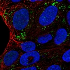 Immunofluorescent staining of human cell line RT4 shows localization to vesicles.