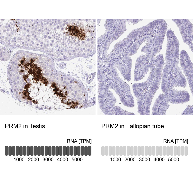 Anti-PRM2 Antibody
