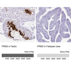 Anti-PRM2 Antibody