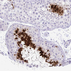 Immunohistochemical staining of human testis shows strong nuclear positivity in spermatids.