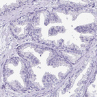 Immunohistochemical staining of human prostate shows no positivity in glandular cells as expected.