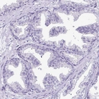 Immunohistochemical staining of human prostate shows no positivity in glandular cells as expected.