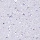 Immunohistochemical staining of human cerebral cortex shows no positivity in neurons as expected.