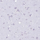 Immunohistochemical staining of human cerebral cortex shows no positivity in neurons as expected.