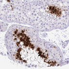 Anti-PRM2 Antibody