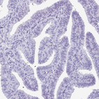 Immunohistochemical staining of human fallopian tube shows no positivity in glandular cells as expected.
