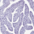 Immunohistochemical staining of human fallopian tube shows no positivity in glandular cells as expected.