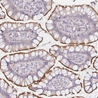 Immunohistochemical staining of human small intestine shows moderate membranous positivity in glandular cells.