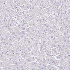 Anti-FGFR1 Antibody