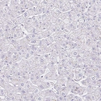 Immunohistochemical staining of human liver shows no positivity in hepatocytes as expected.