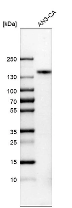 Western blot analysis in human cell line AN3-CA.