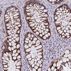 Anti-ZNF813 Antibody