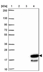Lane 1: Marker [kDa] 250, 130, 95, 72, 55, 36, 28, 17, 10_br/_Lane 2: Human cell line RT-4_br/_Lane 3: Human cell line U-251MG sp_br/_Lane 4: Human plasma (IgG/HSA depleted)