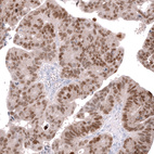 Anti-CDX2 Antibody