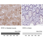 Anti-RYR1 Antibody