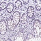 Immunohistochemical staining of human colon shows low expression as expected.