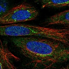 Immunofluorescent staining of human cell line SiHa shows localization to cytosol & the Golgi apparatus.