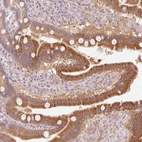 Anti-HEBP1 Antibody
