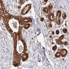 Anti-BTF3 Antibody