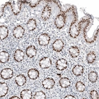 Immunohistochemical staining of human rectum shows strong nuclear positivity in glandular cells.