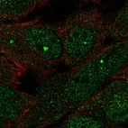 Immunofluorescent staining of human cell line HeLa shows localization to nucleoplasm & nuclear bodies.