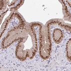 Anti-GLIS3 Antibody