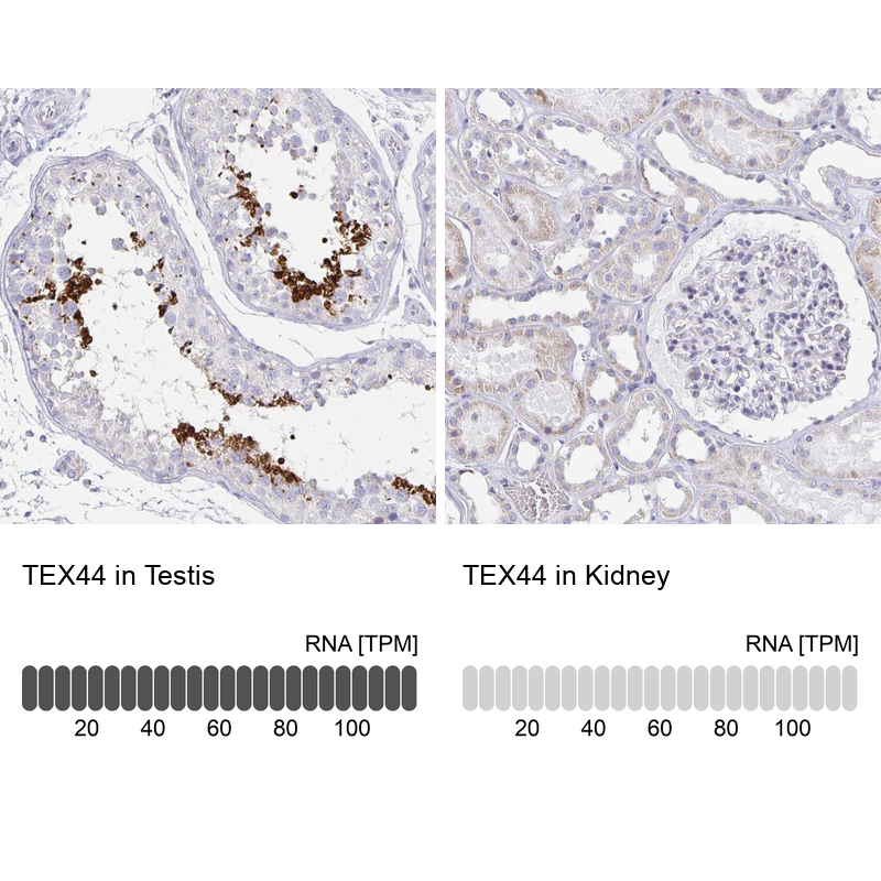 Anti-TEX44 Antibody