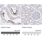 Anti-TEX44 Antibody