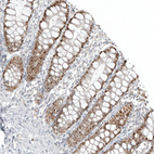 Immunohistochemical staining of human colon shows moderate nuclear positivity in glandular cells.