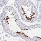 Immunohistochemical staining of human testis shows high expression.