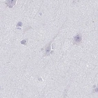 Immunohistochemical staining of human cerebral cortex using Anti-TEX44 antibody HPA056433.
