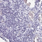 Immunohistochemical staining of human lymph node using Anti-TEX44 antibody HPA056433.