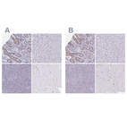 Anti-CHMP5 Antibody