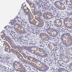 Immunohistochemical staining of human small intestine shows moderate cytoplasmic positivity in glandular cells.