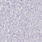 Immunohistochemical staining of human liver shows no cytoplasmic positivity in hepatocytes.