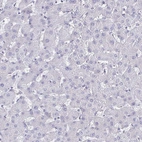 Immunohistochemical staining of human liver shows no cytoplasmic positivity in hepatocytes.