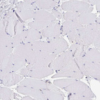 Anti-CHMP5 Antibody