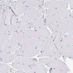 Immunohistochemical staining of human skeletal muscle shows no cytoplasmic positivity in myocytes as expected.
