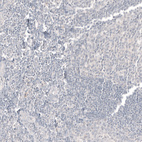 Immunohistochemical staining of human lymph node shows no positivity in non-germinal center cells as expected.
