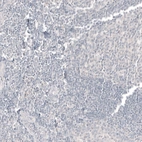 Immunohistochemical staining of human lymph node shows no positivity in non-germinal center cells as expected.