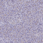 Anti-CHMP5 Antibody