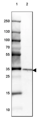 Lane 1: Marker [kDa] 250, 130, 100, 70, 55, 35, 25, 15, 10_br/_Lane 2: Human Kidney tissue