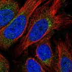 Anti-STX10 Antibody