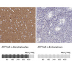 Anti-ATP1A3 Antibody