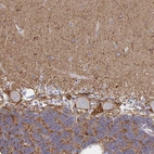 Immunohistochemical staining of human cerebellum shows strong membranous positivity in Purkinje cells.