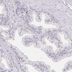 Immunohistochemical staining of human prostate shows no positivity in glandular cells as expected.