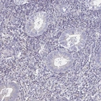Immunohistochemical staining of human endometrium shows no positivity in glandular cells as expected.