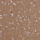 Immunohistochemical staining of human cerebral cortex shows strong positivity in neuropil.