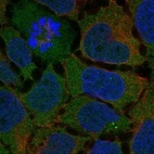 Anti-ADGRG7 Antibody